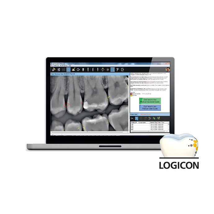 Logicon